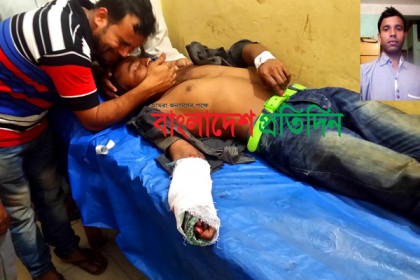 লামায় গুড়ের মেশিনে কাজ করতে গিয়ে যুবকের হাত বিচ্ছিন্ন