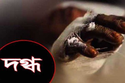 মুগদায় গ্যাস লাইনের লিকেজ থেকে আগুন, দগ্ধ ৫