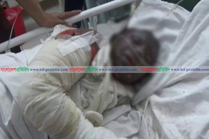 সাভারে গ্যাস লাইন লিক হয়ে নারীসহ দগ্ধ ২