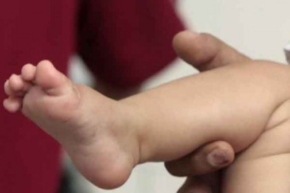 খৎনা করলে ৬ বছরের কারাদণ্ড, তীব্র ক্ষোভ
