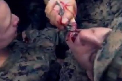 যেভাবে সাপ বা মাকড়সার রক্ত খেতে হয়! (ভিডিও)

