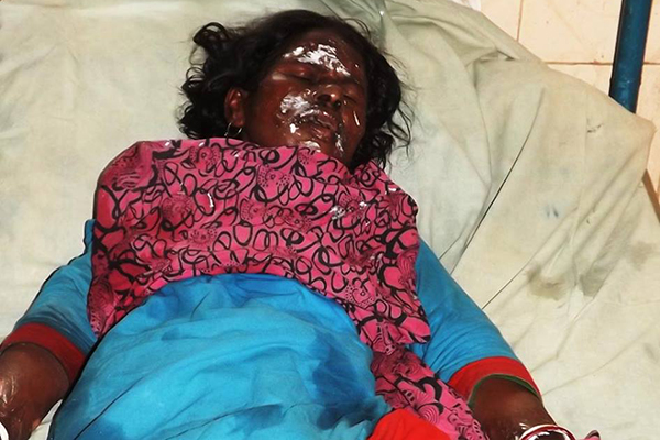 দিনাজপুরে জুট মিলে অগ্নিকাণ্ডে দগ্ধ ১২