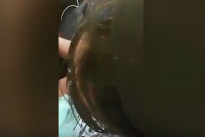এত উকুন! (ভিডিও)