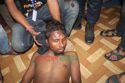 হামলাকারীর অবস্থা আশঙ্কাজনক