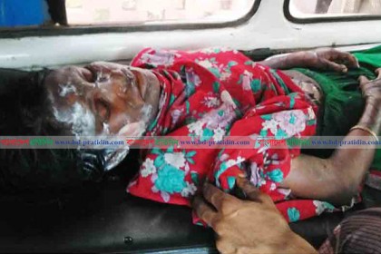 শরীরে আগুন ধরিয়ে গৃহবধূর আত্মহত্যার চেষ্টা