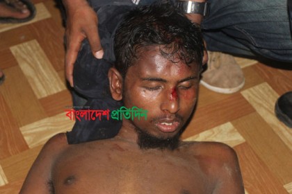 আশঙ্কাজনক অবস্থায় হামলাকারীও সিএমএইচে ভর্তি