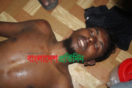 জাফর ইকবালের ওপর হামলাকারীর পরিচয় শনাক্ত 