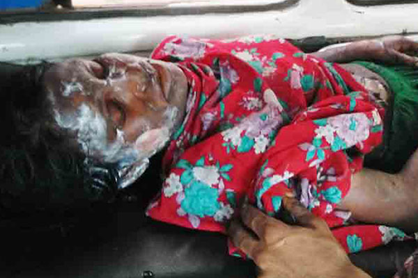 অবশেষে মারা গেলেন অগ্নিদগ্ধ সেই গৃহবধূ