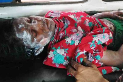অবশেষে মারা গেলেন অগ্নিদগ্ধ সেই গৃহবধূ