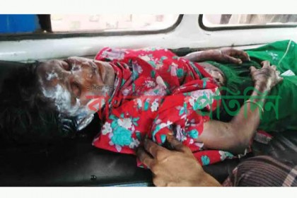 স্বামীর দেওয়া আগুনে স্ত্রী'র মৃত্যু!