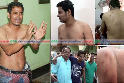বরিশালে সাংবাদিককে অমানবিক নির্যাতন, ৮ পুলিশ প্রত্যাহার
