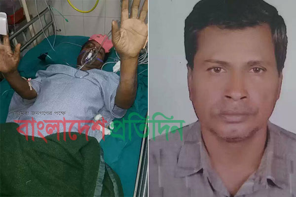 কাঠমান্ডুতে বিমান দুর্ঘটনা; দুই পা ভেঙে গেছে কবিরের