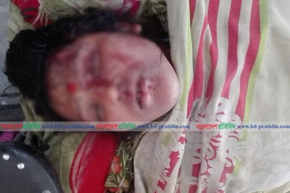 বরিশালে ৭ মাসের অন্তঃসত্ত্বাকে কুপিয়ে জখম