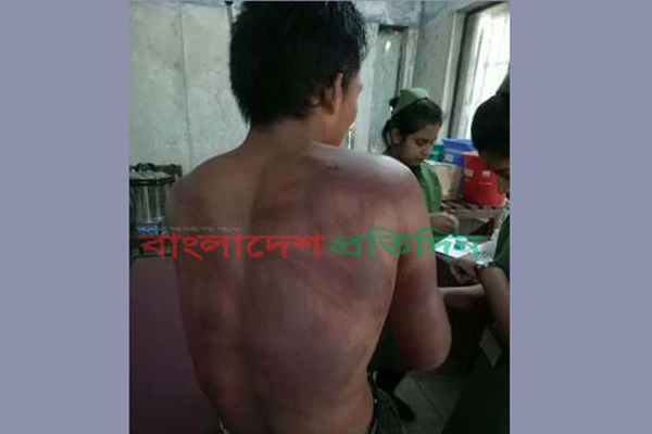 রাঙামাটির বিলাইছড়িতে শিক্ষককে পিটিয়ে আহত