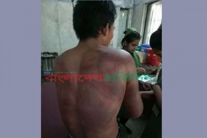 রাঙামাটির বিলাইছড়িতে শিক্ষককে পিটিয়ে আহত