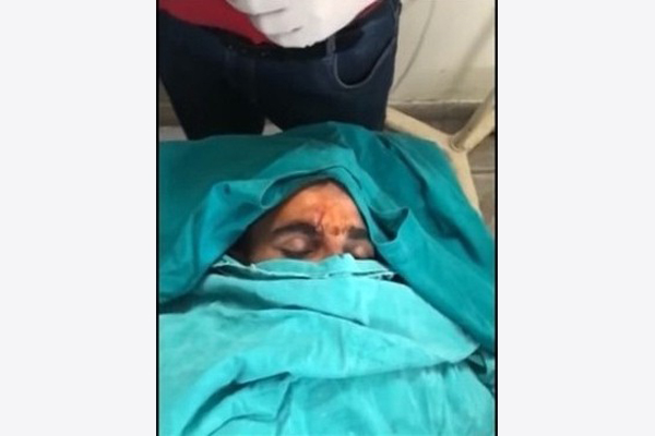 সড়ক দুর্ঘটনায় শামির কপালে সেলাই