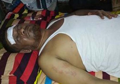 গৌরনদীতে যুবদল সভাপতিকে হাতুড়িপেটা, হাসপাতালে ভর্তি