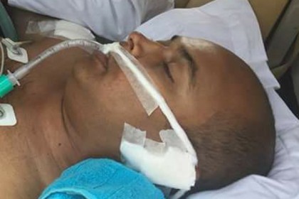 ঝড়ে আহত সেই যুবলীগ নেতা এখন ঢাকায়, অবস্থা আশঙ্কাজনক 
