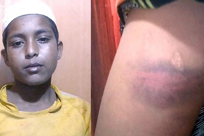 কলাপাড়ায় মাদ্রাসায় হাত-পা বেধে শিশুকে মারধরের অভিযোগ
