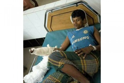 লামায় করাতকলে শ্রমিকের হাত বিচ্ছিন্ন