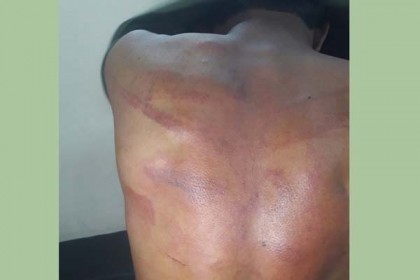 রাবি শিক্ষার্থীকে বেধড়ক পেটাল রামেক ছাত্রলীগ নেতা

