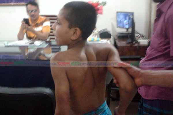 ফুলপুরে মাদ্রাসা শিক্ষকের প্রহারে ছাত্র আহত