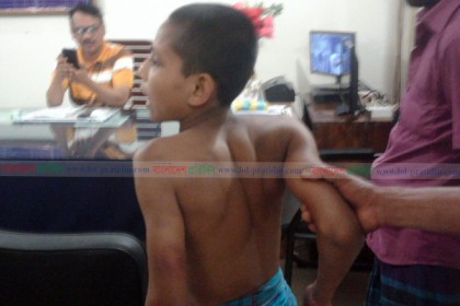 ফুলপুরে মাদ্রাসা শিক্ষকের প্রহারে ছাত্র আহত