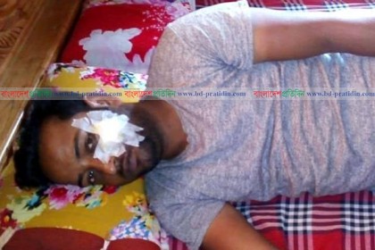 ঝিনাইদহে ভাবির কামড়ে দেবর আহত!