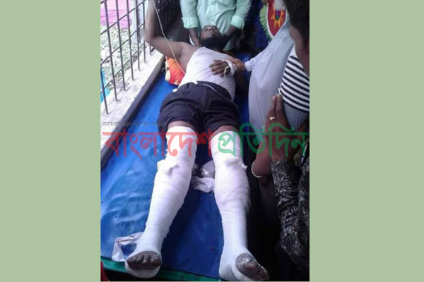 বাসের চাপায় রাজীবের হাত হারানোর পর এবার দু’পা হারাচ্ছেন সিরাজ

