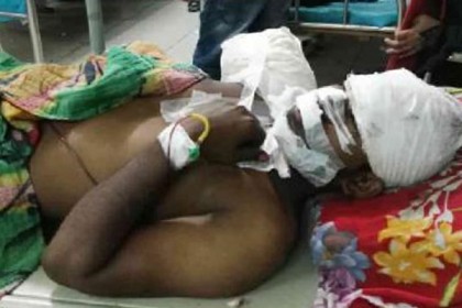 এবার বেপরোয়া ট্রাকের ধাক্কায় হাত হারালেন পরিবহন শ্রমিক