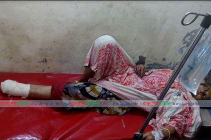 শরণখোলায় দুর্বৃত্তের আঘাতে বৃদ্ধার পা বিচ্ছিন্ন
