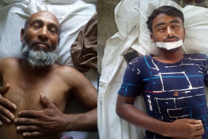 কলারোয়ায় প্রতিপক্ষের হামলায় আহত ২
