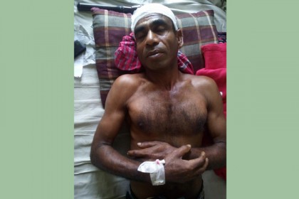 অবাধ্য সন্তানের প্রহারে পিতা হাসপাতালে ভর্তি
