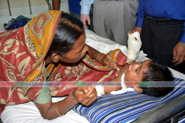 বগুড়ায় ট্রাকের ধাক্কায় হাত হারানো সুমি এখন শঙ্কামুক্ত