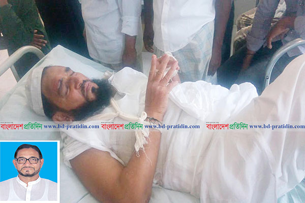 পাথরঘাটায় সড়ক দুর্ঘটনায় সাবেক এমপি হিরু আহত