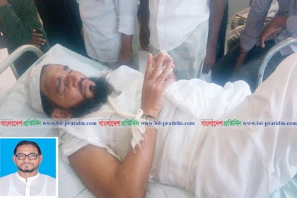 পাথরঘাটায় সড়ক দুর্ঘটনায় সাবেক এমপি হিরু আহত