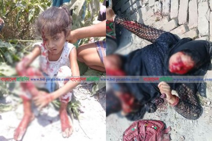 মেরিন ড্রাইভ সড়কে দুর্ঘটনায় মা-মেয়ে আহত