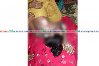 চরফ্যাশনে স্ত্রীকে পুড়িয়ে হত্যাচেষ্টায় স্বামী গ্রেফতার