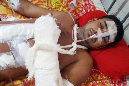 যৌন হয়রানির প্রতিবাদ করায় ৪ জনকে কুপিয়ে জখম