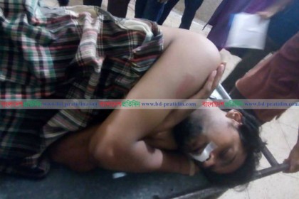 কোটা আন্দোলনকারী জবি শিক্ষার্থীর ওপর সন্ত্রাসী হামলা, ঢামেকে ভর্তি
