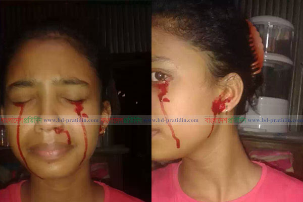 চোখ-নাক-কান থেকে অঝরে রক্ত ঝরে নাদিয়ার