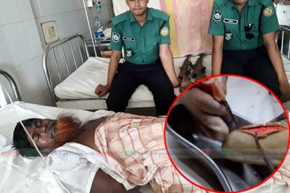 অপারেশন করে পেট থেকে ১ হাজার পিস ইয়াবা উদ্ধার!
