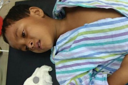 কাঁটাছেড়া ছাড়াই বের করা হল গলায় আটকে যাওয়া কয়েন