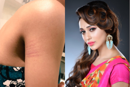 মিমির শরীরে 'দাগ' অতঃপর...
