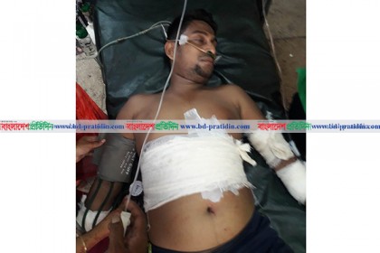 খুলনায় পুলিশের সোর্সকে কুপিয়েছে মাদক ব্যবসায়ীরা
