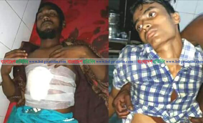 আর্জেন্টিনা সমর্থকদের ছুরিকাঘাতে তিন ব্রাজিল সমর্থক আহত