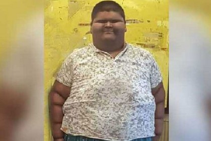 ১৪ বছরেই ওজন ২৩৭ কেজি! 