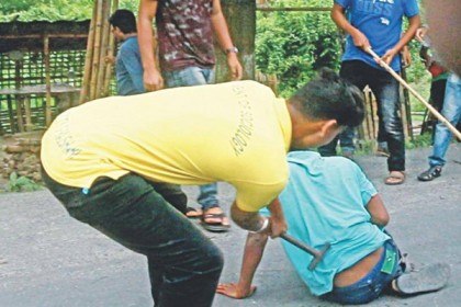 শুধু পা নয়, তরিকুলের মেরুদণ্ডের হাড়ও ক্ষতিগ্রস্ত হয়েছে