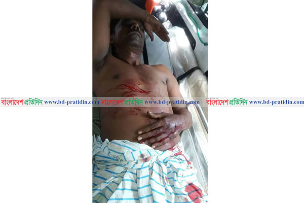 মুন্সীগঞ্জে যুবককে কুপিয়ে জখম