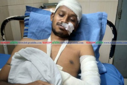 জবি শিক্ষার্থীদের উপর স্থানীয়দের হামলা, আহত ৩